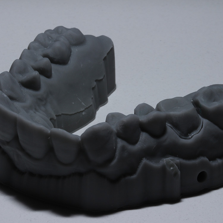 Диагностическая модель зубов 3D, принтовая.