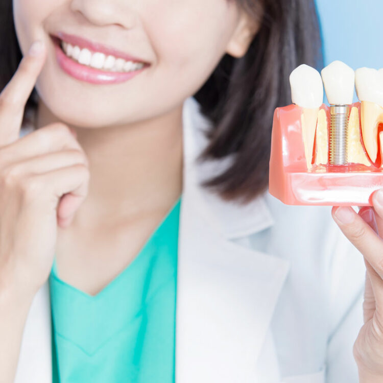 Мифы о зубной имплантации